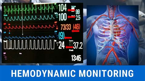 [Hemodynamic monitoring